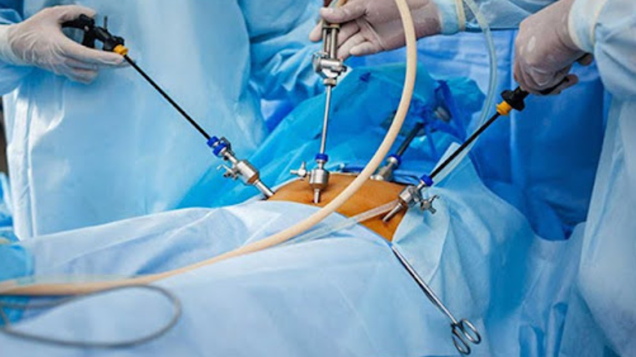 Minimally invasive laparoscopic hernia surgery